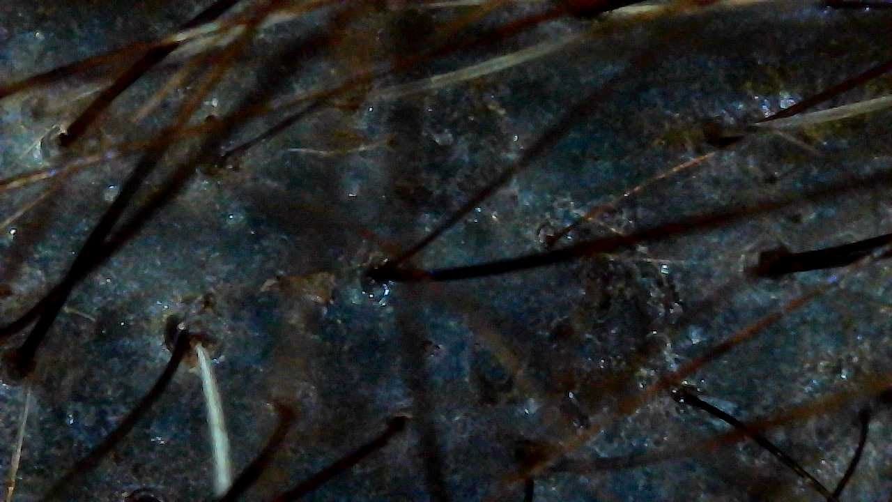 Trichoscopy close-up of hair and scalp