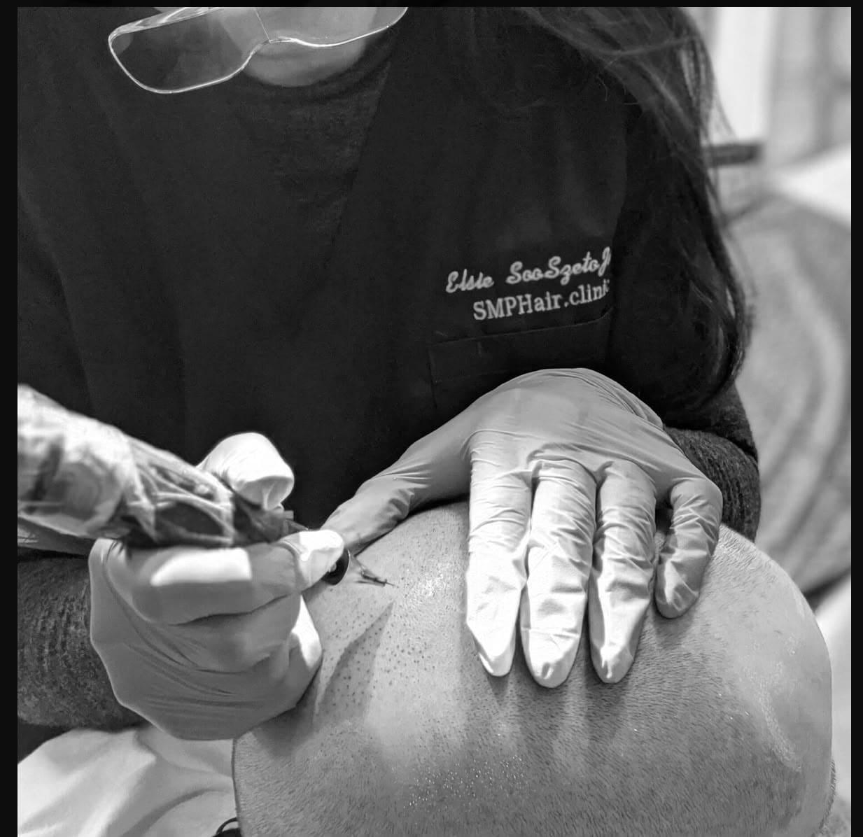 Elsie performing scalp micropigmentation on a client