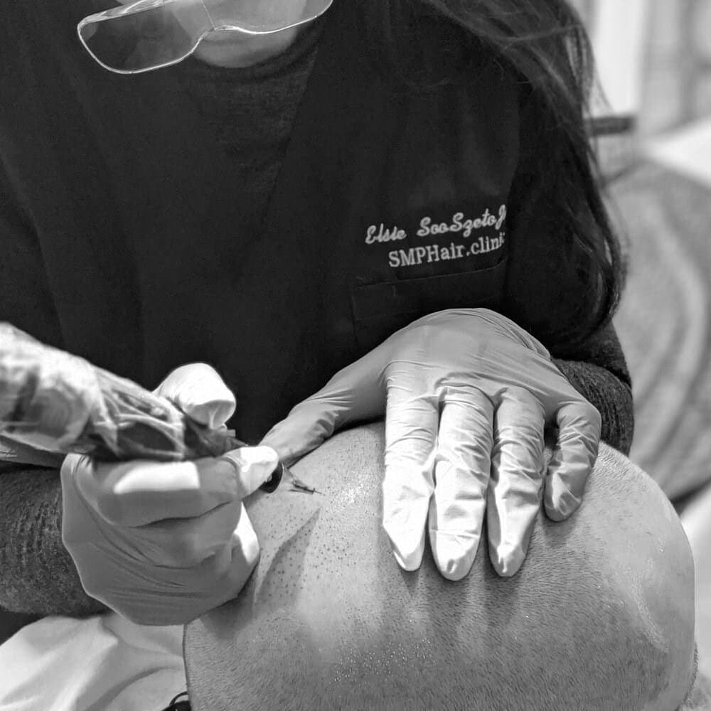 Elsie performing scalp micropigmentation on a client