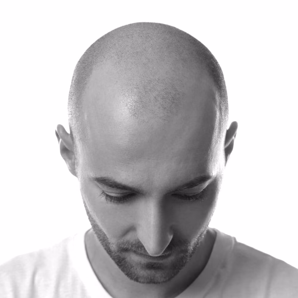 Man with a shaved head