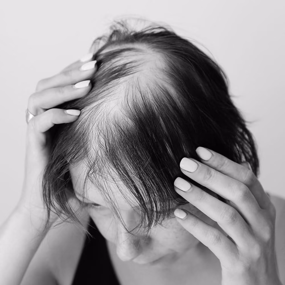 Woman with thinning hair