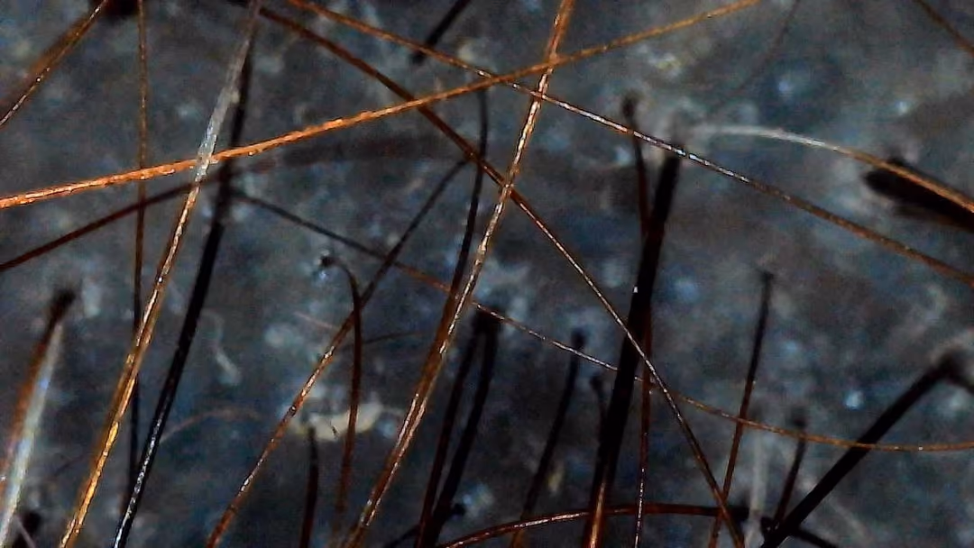 Trichoscopy close-up of hair and scalp