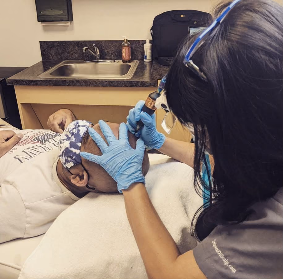 Elsie performing scalp micropigmentation on a client